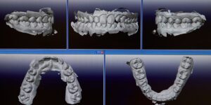 How Digital Technology Is Revolutionizing Dentistry