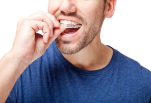 How Much Does Invisalign Cost in Cupertino, CA?